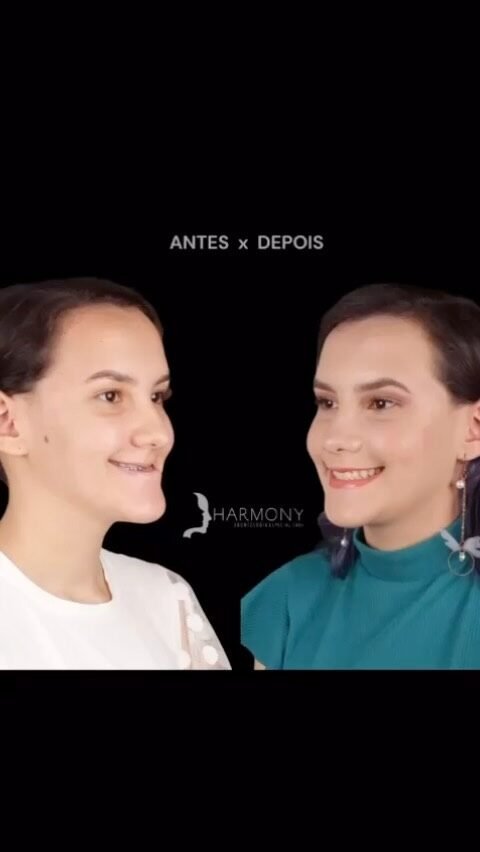 Instagram post from valeortognatica. This post is in position 14.