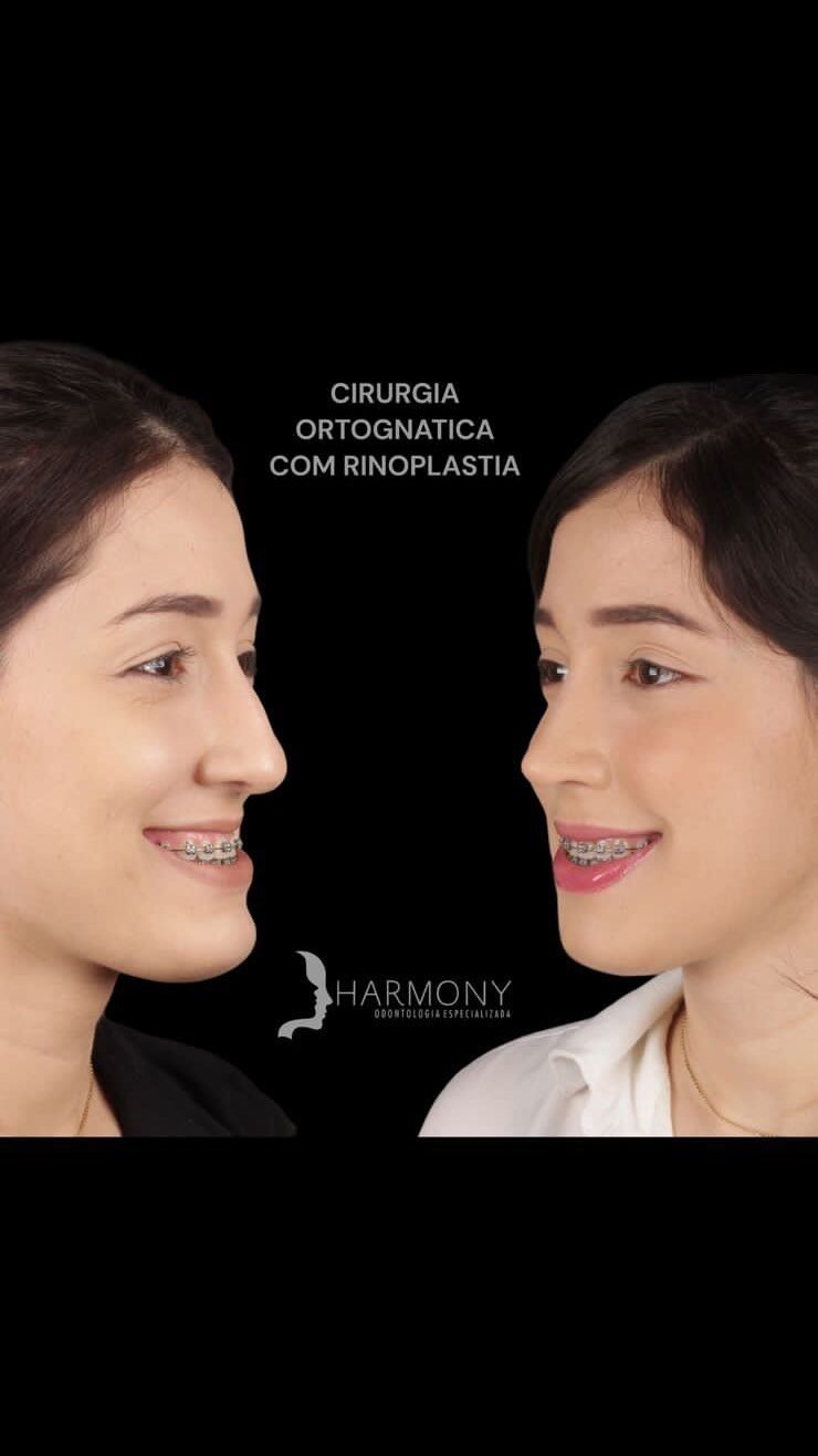 Instagram post from valeortognatica. This post is in position 13.
